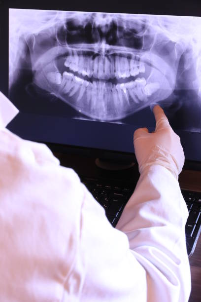 Best Emergency Treatment for Dental Infections or Abscesses in Seabrook, MD