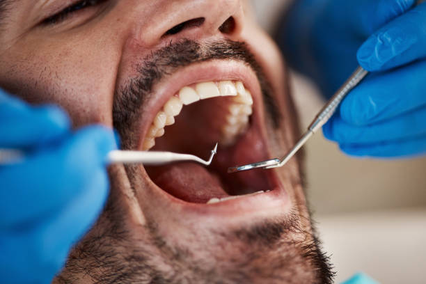 Best Emergency Root Canal Treatment in Seabrook, MD
